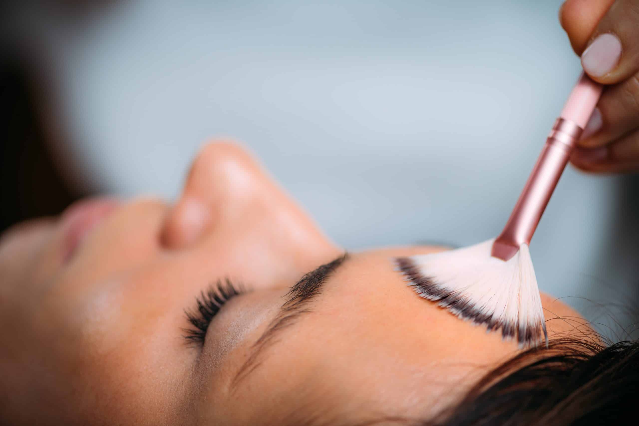 How Chemical Peels Help with Acne and Scarring.