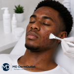 Salicylic Clear Skin Peel