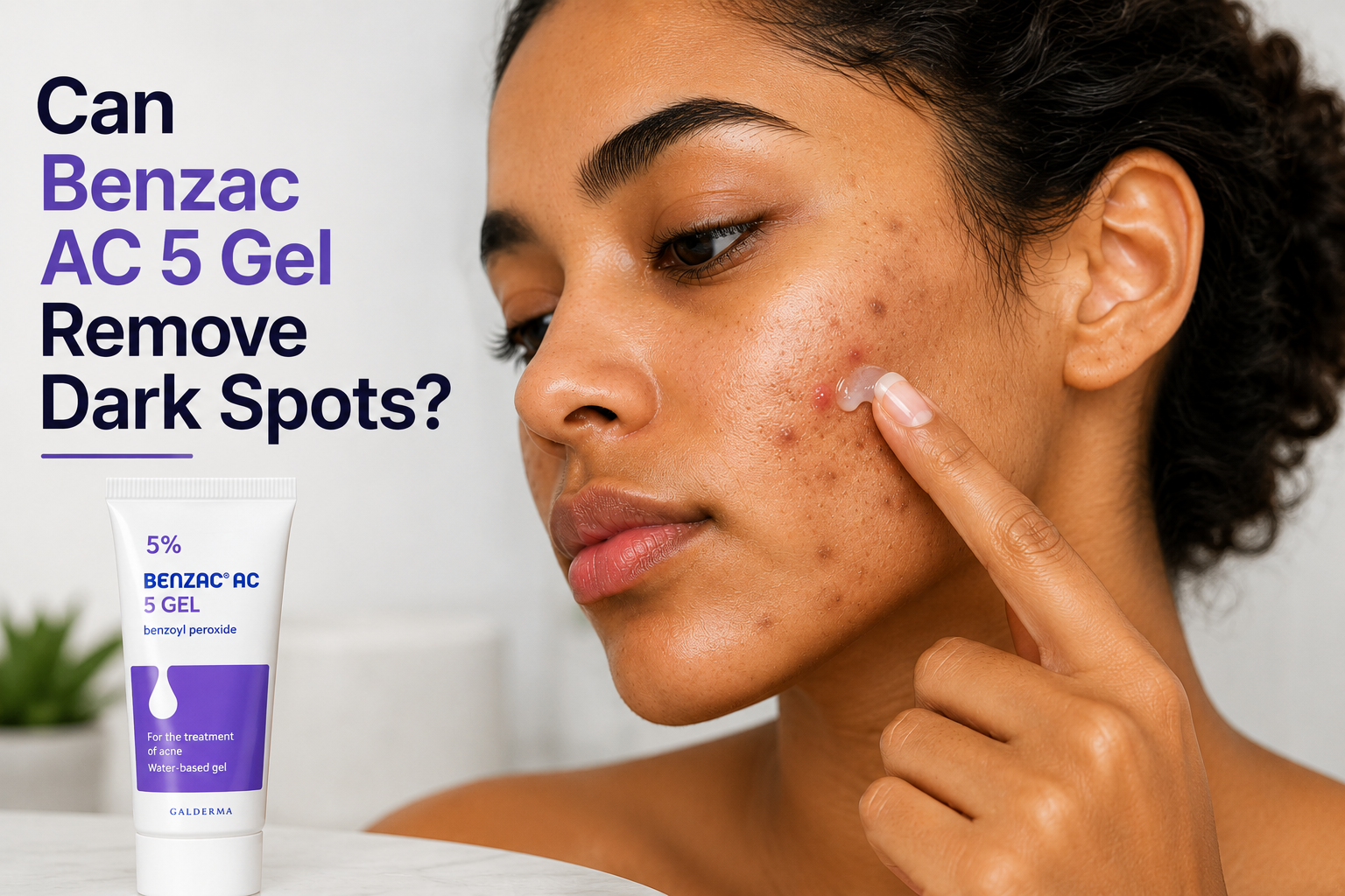 Does Benzac AC 5 Gel Remove Dark Spots? Person applying Benzac AC 5 Gel to active acne with dark spots visible on the face.