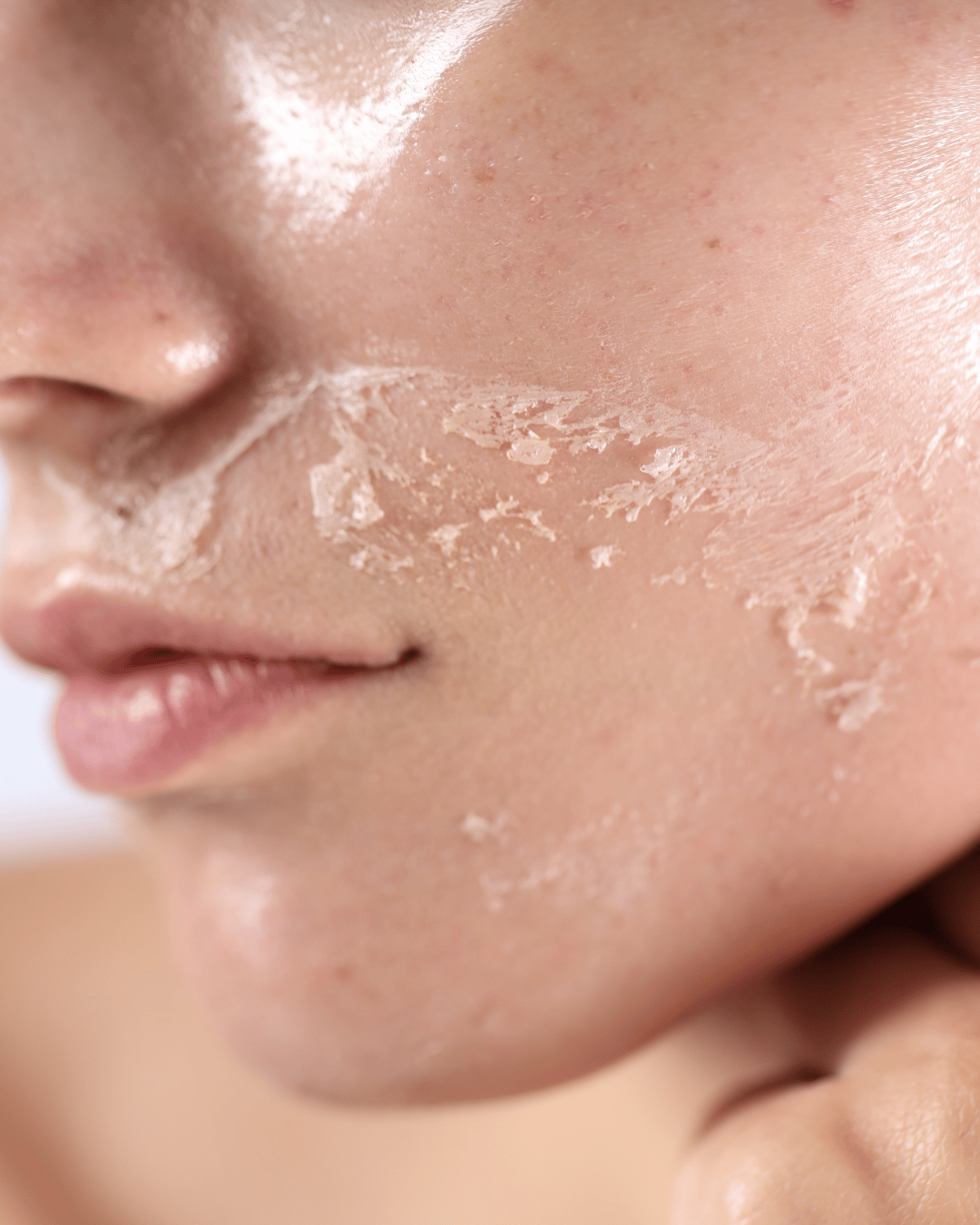 winter skincare